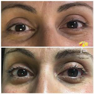 eyelash lift - Brow &amp; Lash Care