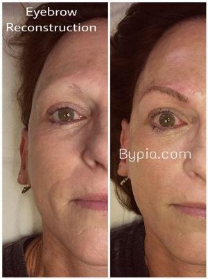 eyebrow microblading - microfeathering