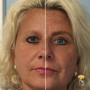 microblading