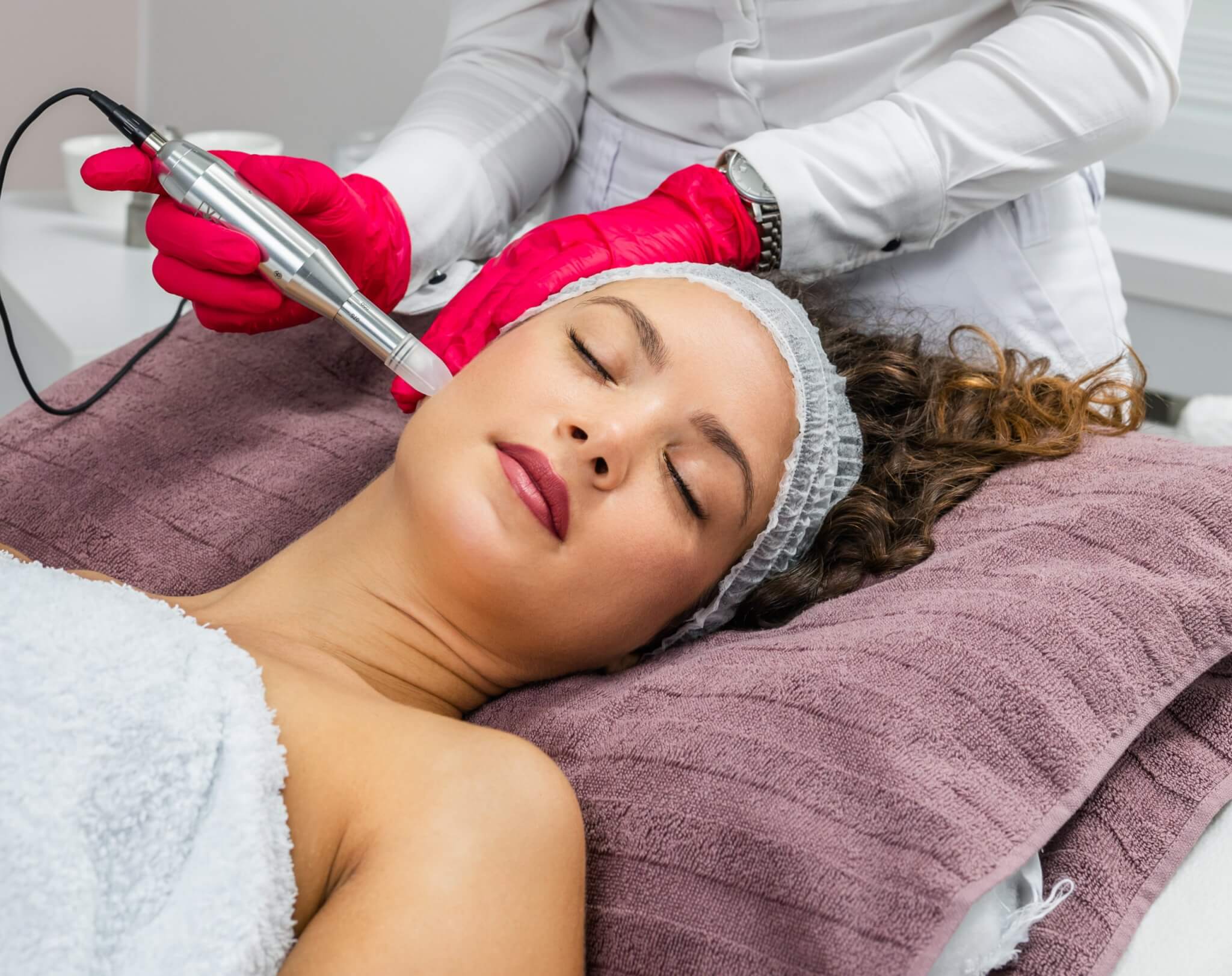 Microneedling experts in Tampa Florida