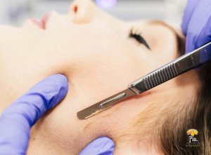 Dermaplaning Coming Soon!