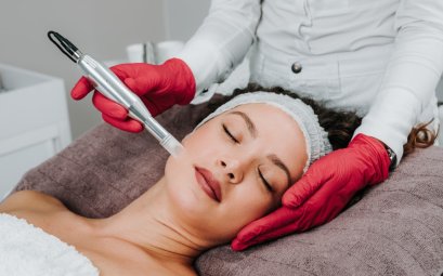 Woman receiving microneedling treatment - Tampa Bay.